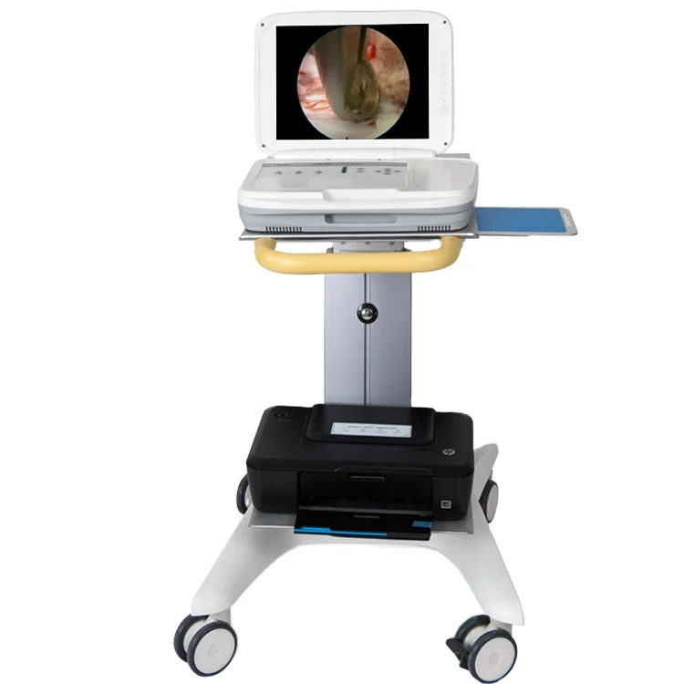 Medical Lab Images - YKD-9003: draagbaar, geïntegreerd Full HD-endoscopiesysteem voor