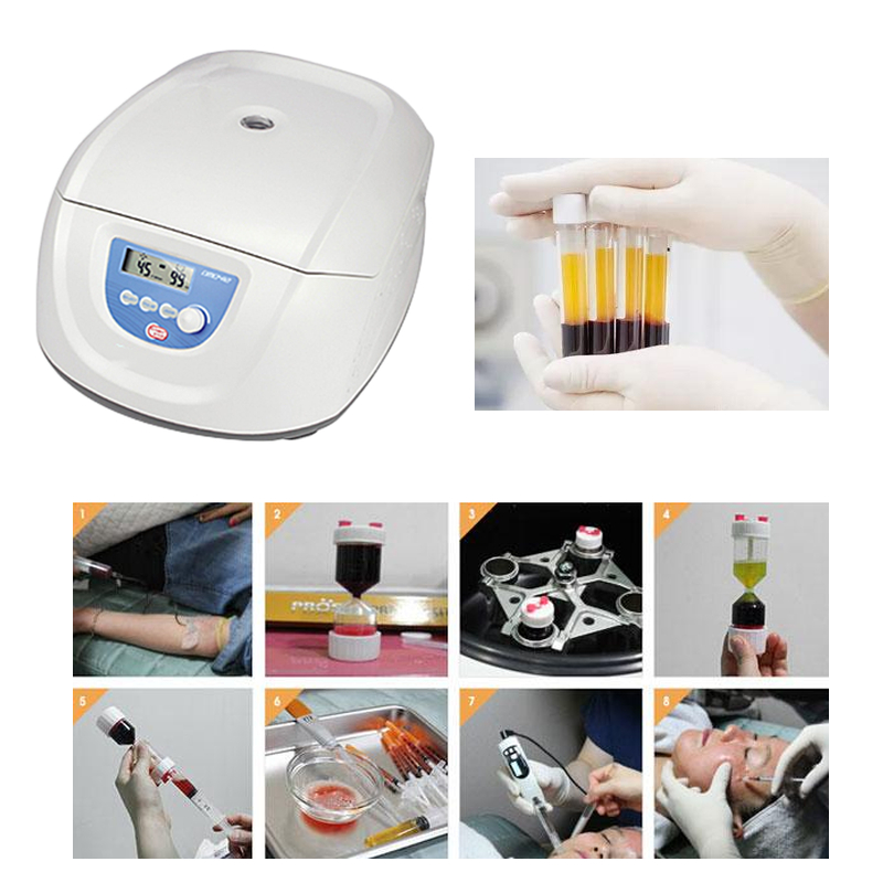 Bestseller Medische Bloed PRP  - Medical Lab Center recensie en prijs